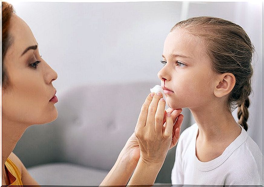 How to treat and prevent nosebleeds in children