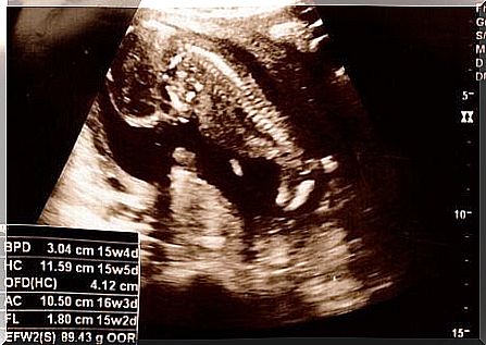 ultrasound image from the fifteenth week of pregnancy