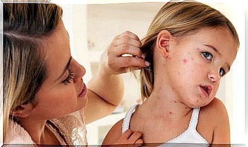 mother shows off neck of girl with measles