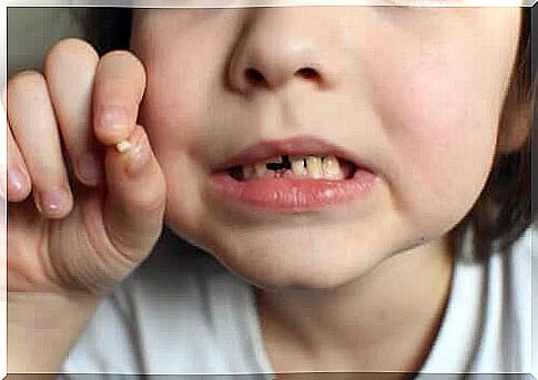 Impacts on baby teeth: What to do