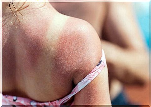 Tanning in children: why is it so dangerous?