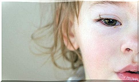 Children with conjunctivitis.